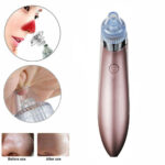 Blackhead Vacuum Remover – Strong Suction & Pore Cleaner for Clear Skin - Image 9