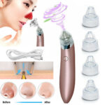 Blackhead Vacuum Remover – Strong Suction & Pore Cleaner for Clear Skin