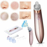 Blackhead Vacuum Remover – Strong Suction & Pore Cleaner for Clear Skin - Image 8